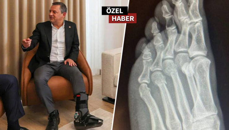 Özgür Özel’in ayağını kim kırdı? 101’inci yılını kutlayan CHP’nin destekçilerinin meze olan meselesi