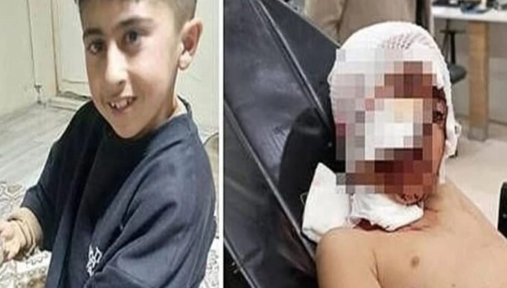 Ekmek almaya giderken başıboş sokak köpeklerinin saldırdığı çocuk ağır yaralandı