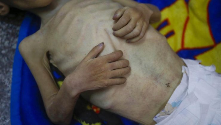 Gazze’de açlıktan ölenlerin sayısı 460’a yükseldi