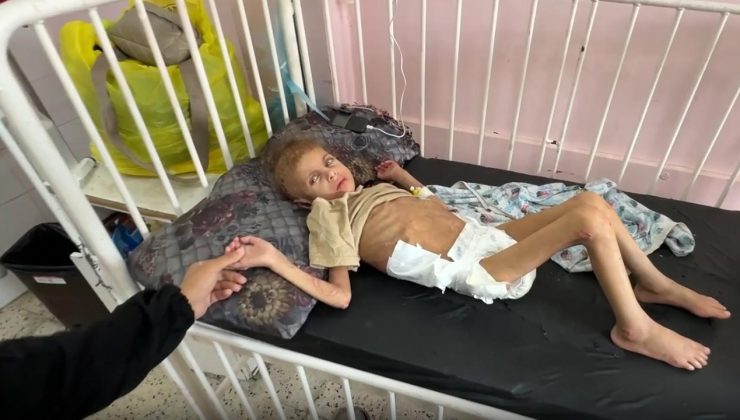 Gazze’de yetersiz beslenme sonucu 12 kiloya düşen 7 yaşındaki May yürüme yetisini kaybetti