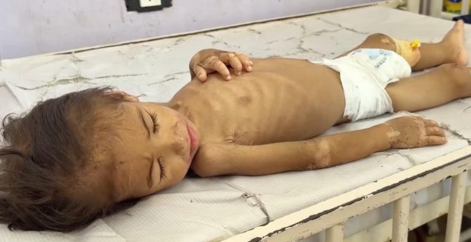 Gazze’de son 24 saatte 1’i çocuk 3 kişi daha açlıktan hayatını kaybetti