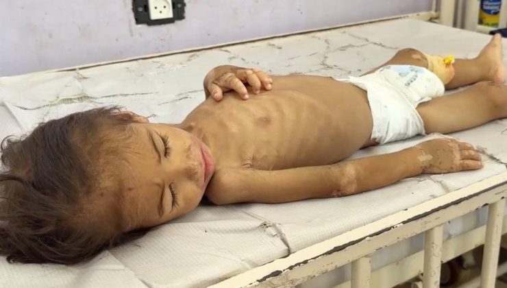 Gazze’de son 24 saatte 1’i çocuk 3 kişi daha açlıktan hayatını kaybetti