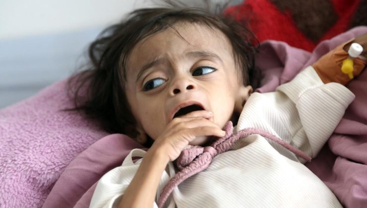 BM’den Yemen’de insani kriz uyarısı